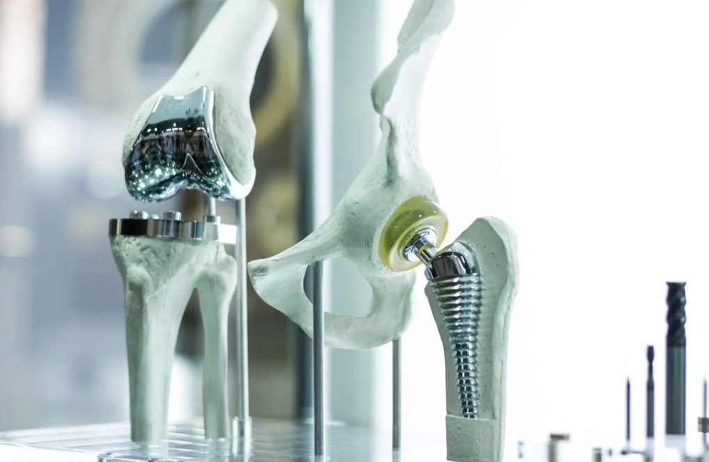 Titanium and stainless steel orthopedic implants displaying biocompatible corrosion-resistant materials for medical applications